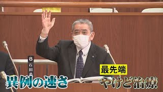 全身40％の重いやけどを負った男性の回復までの軌跡　救急医療体制の強化を誓う