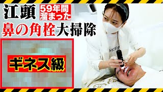 【いちご鼻】59年間放置した江頭のブラックヘッドを毛穴洗浄したらチンアナゴが出てきた