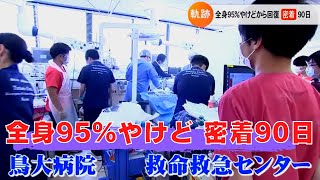 全身95％やけどからの奇跡の生還　鳥取大学医学部附属病院救命救急センターの90日間に密着
